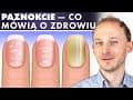 Co paznokcie mówią o Twoim zdrowiu? Odczytaj choroby i niedobory z paznokci | Dr Bartek Kulczyński